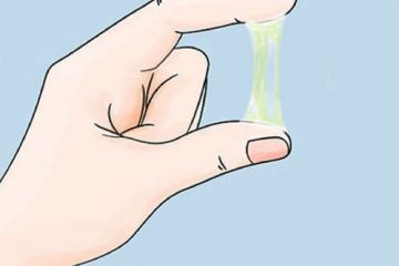 Khí hư ở tuổi dậy thì: Những điều cần biết