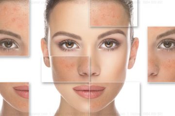 Giải đáp 9 câu hỏi không thể bỏ qua về da nhạy cảm