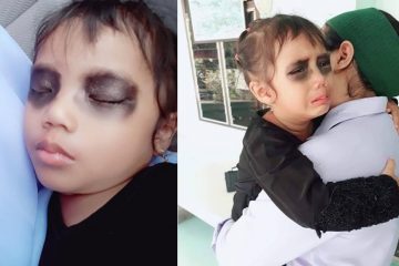 Vẽ quầng thâm mắt cai nghiện smartphone khiến con khóc thét, bà mẹ tiết lộ kết quả