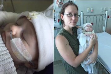 Bà mẹ “chết lặng” khi nghe bác sĩ nói nguyên nhân khiến con thập tử nhất sinh là do… sữa mẹ