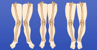 5 vấn đề ở chân con cha mẹ tưởng nguy hiểm nhưng không nên lo lắng