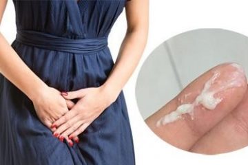 Viêm âm đạo do vi khuẩn: Triệu Chứng & Cách Điều Trị Hiệu Quả Nhất