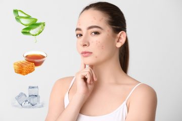 Bật mí 2 lý do gây mụn viêm đỏ không nhân ở tuổi dậy thì bạn nên biết